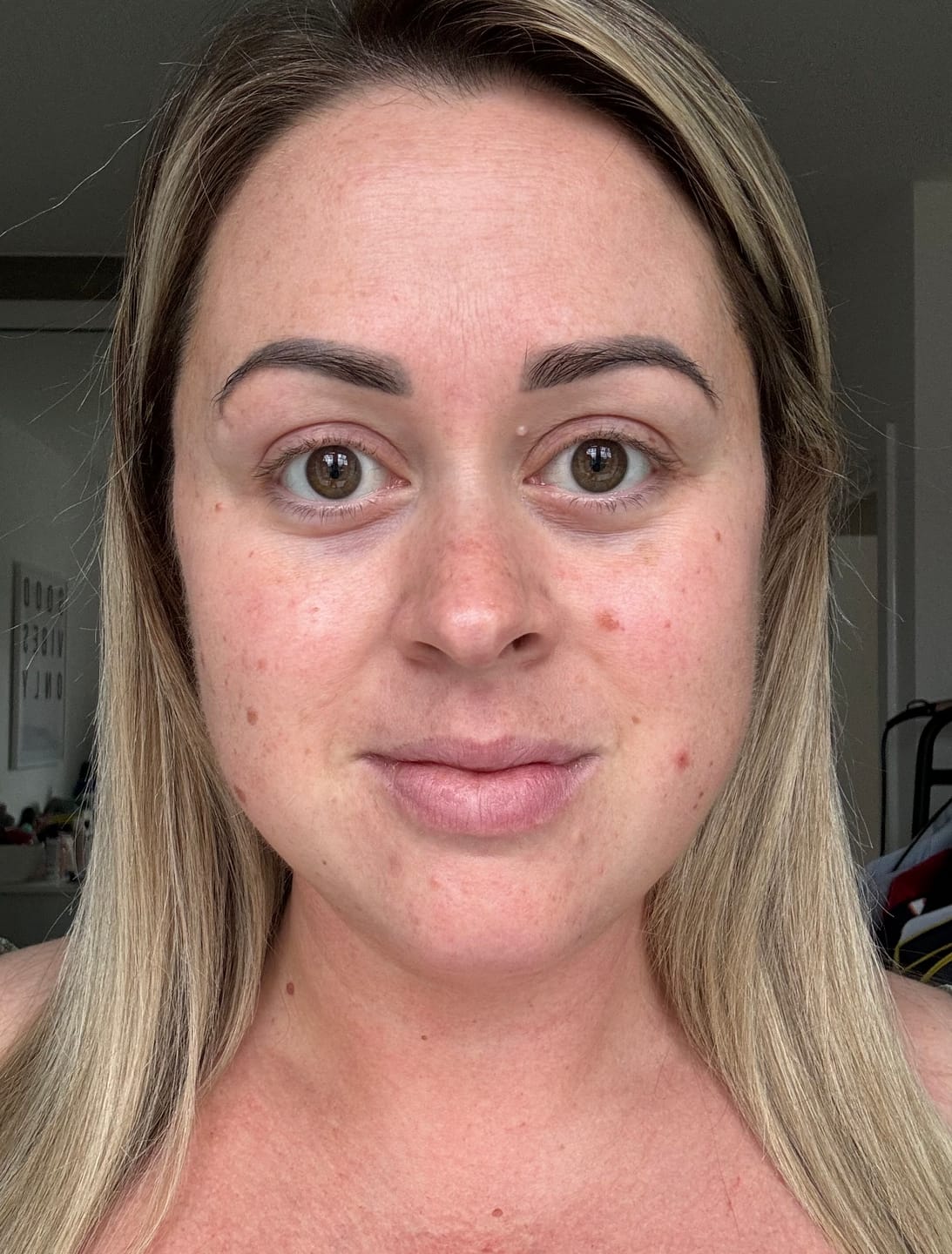 Customer photo review of Anti-Fatigue Eye Mask