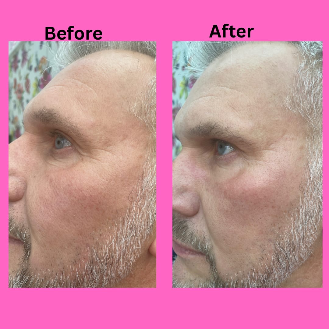 Customer photo review of Anti-Fatigue Eye Mask