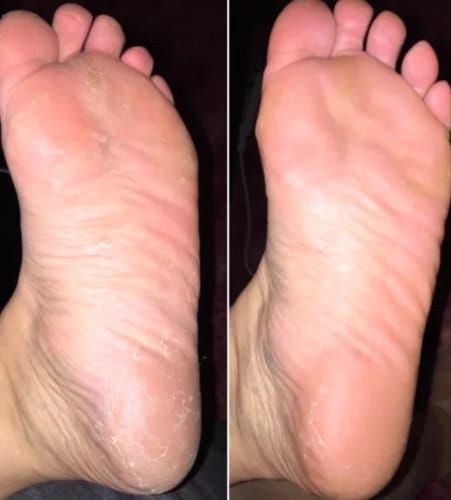 Customer photo review of Daily Fresh Natural Foot & Shoe Deodorizer - Sale