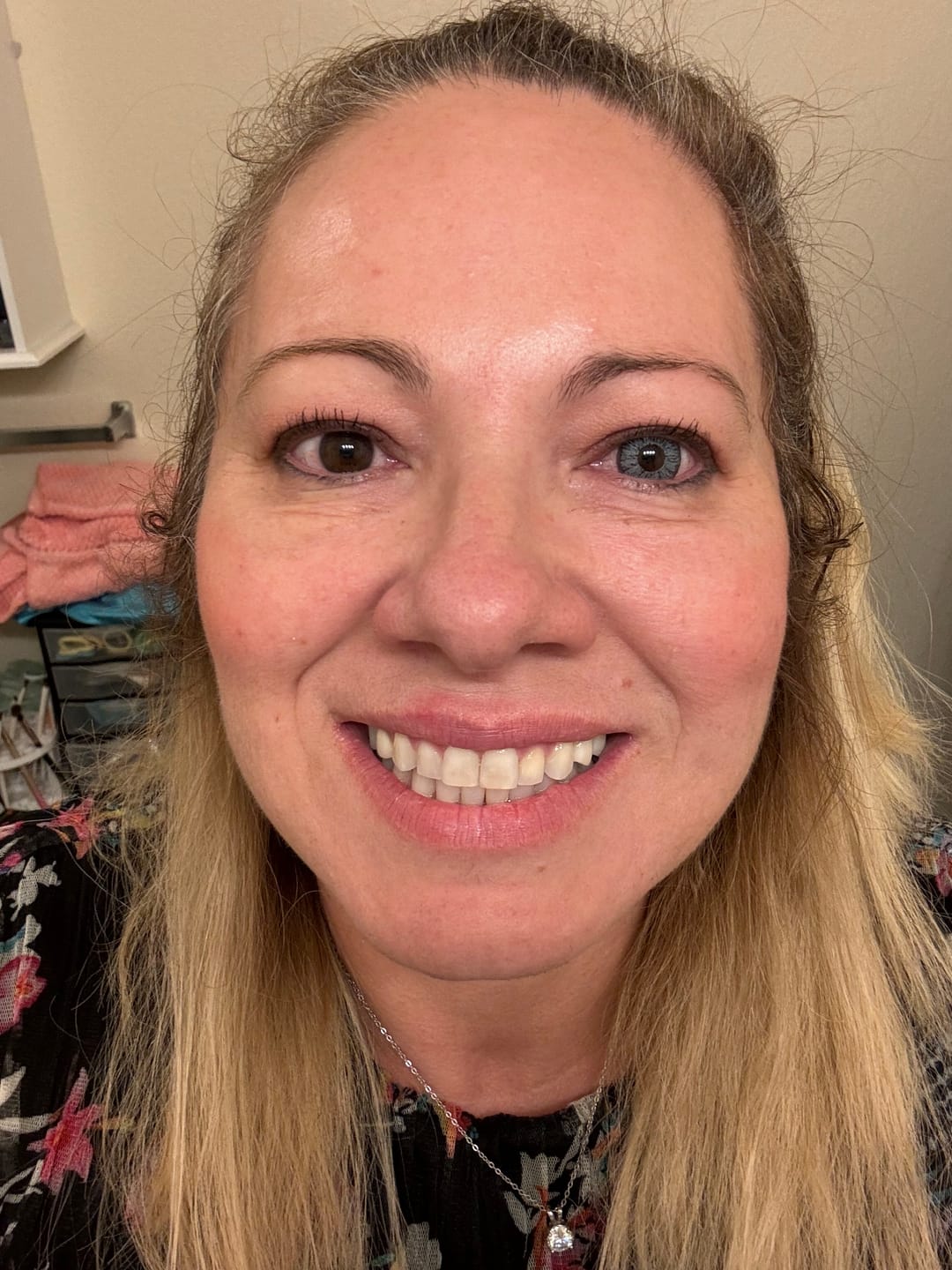 Customer photo review of Super Pinky Gray
