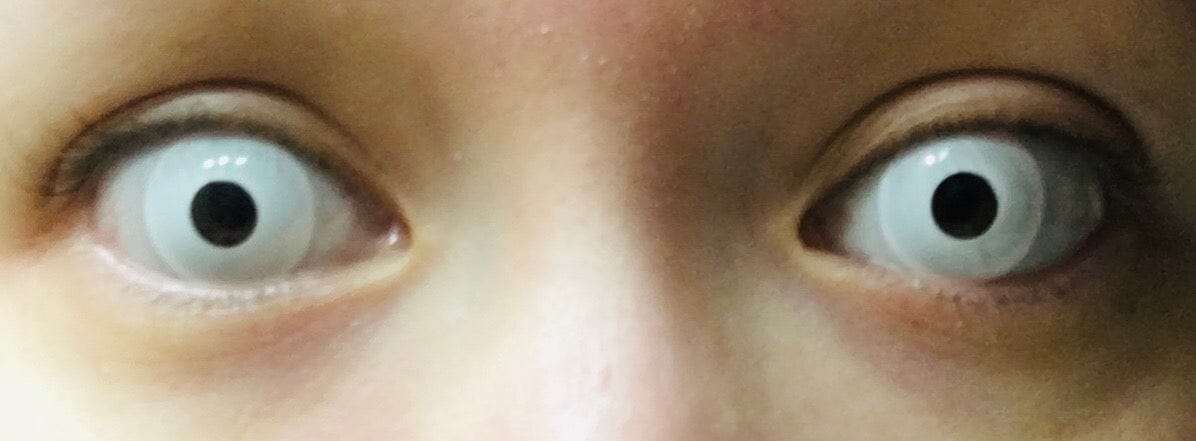Customer photo review of Intense White Crazy Lens