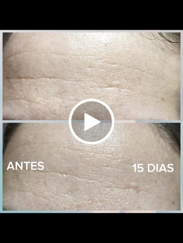 Customer video review of Serum antiedad arrugas y flacidez  TULUM