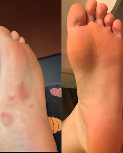 Customer photo review of Daily Fresh Natural Foot & Shoe Deodorizer - Sale