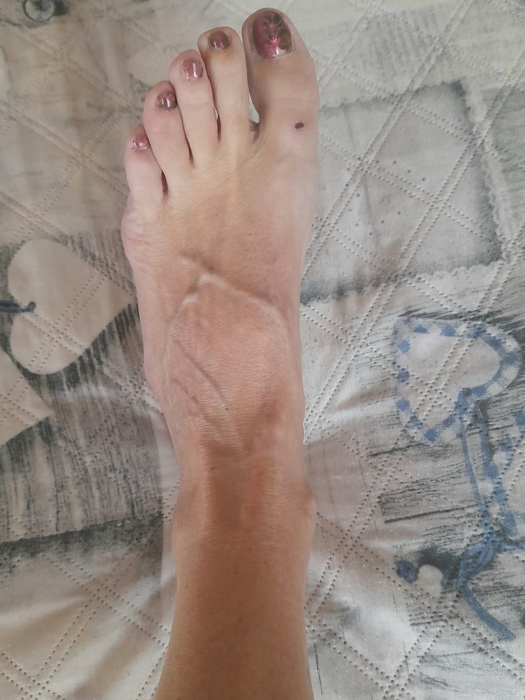 Customer photo review of Smalto Semipermanente LCI -  CAT 02 - 5D
