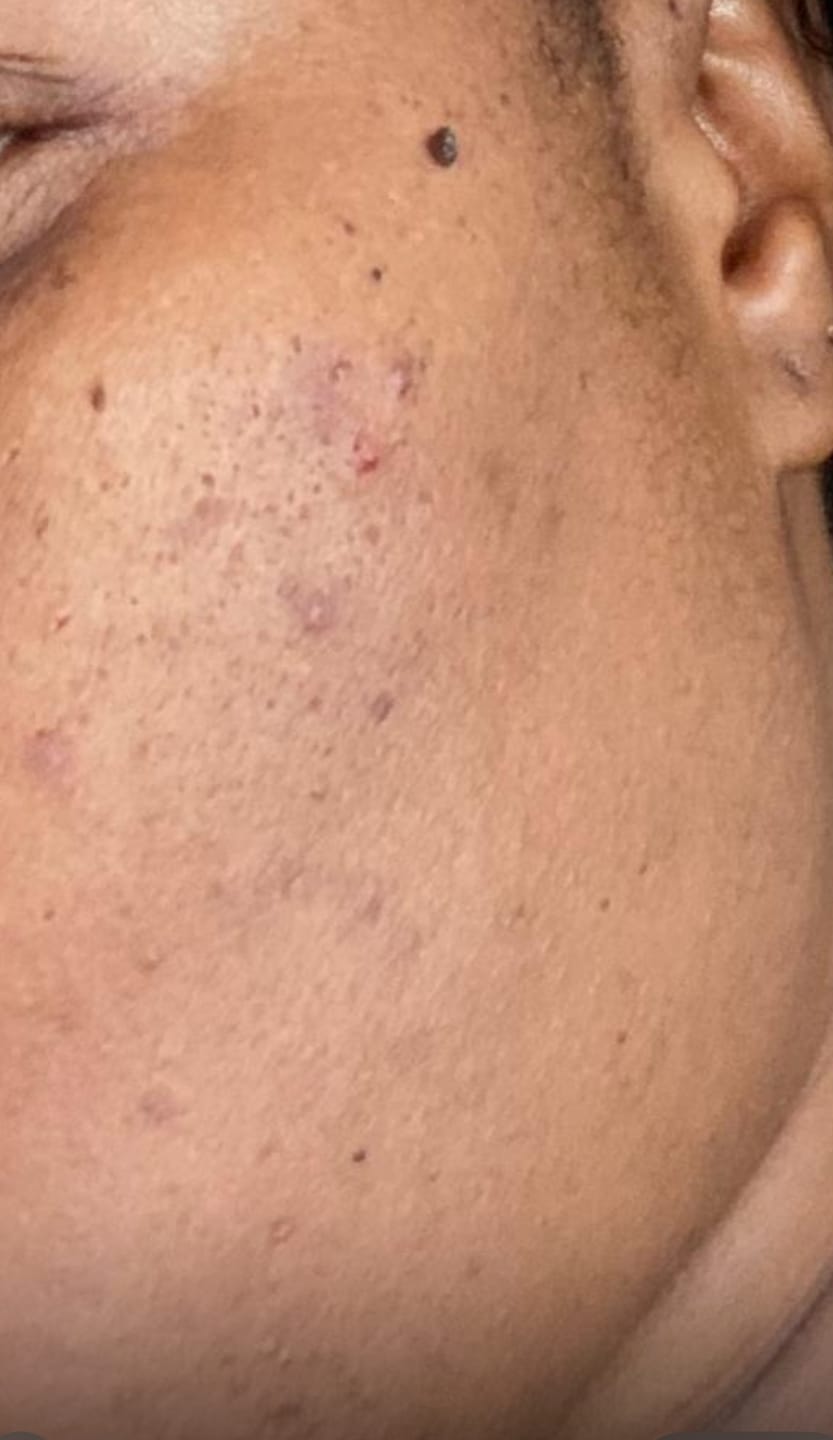 Customer photo review of Luminous Skin Glow With Collagen