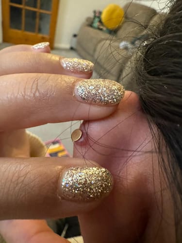 Customer photo review of Piercing Bump Treatment - Bump, Keloid & Scar Relief Oil
