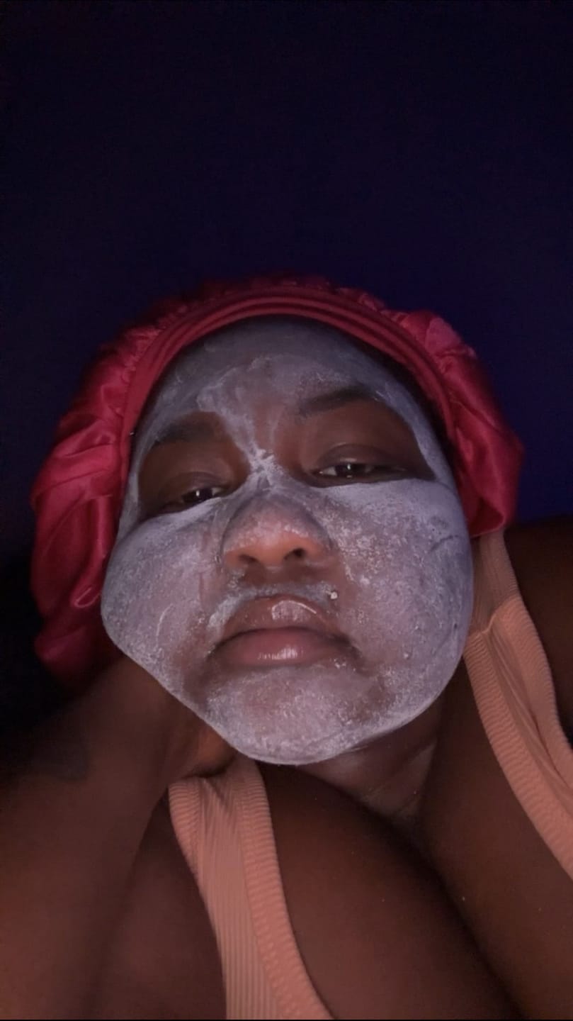 Customer photo review of CALMING ACNE MASK