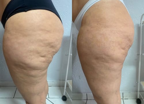 Customer photo review of Bumbum Cream