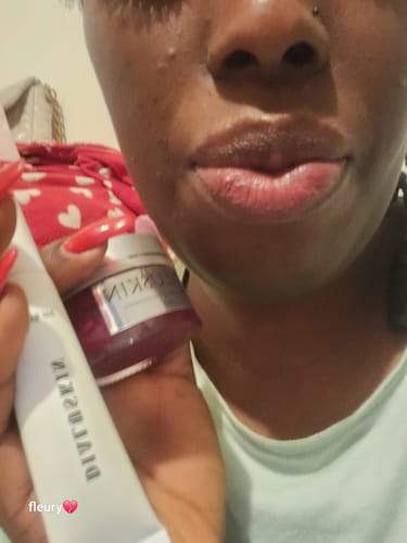 Customer photo review of Baume à lèvres éclaircissant rose permanent