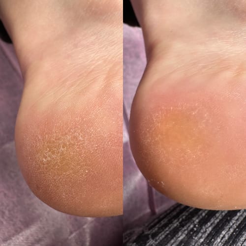 Customer photo review of Seyskyn Crystal Clear Glass Foot File