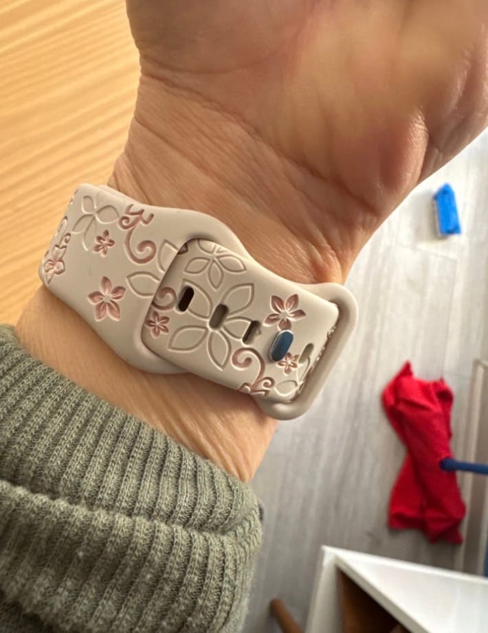 Customer photo review of NEU: Apple Watch Silikonband 'Dianne'