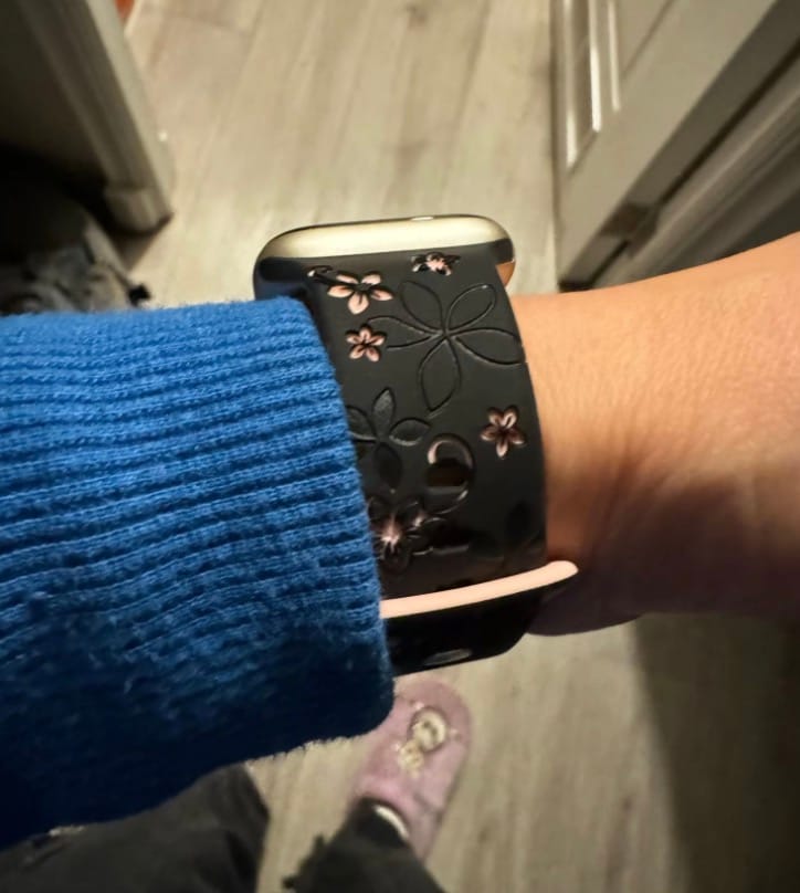 Customer photo review of NEU: Apple Watch Silikonband 'Dianne'