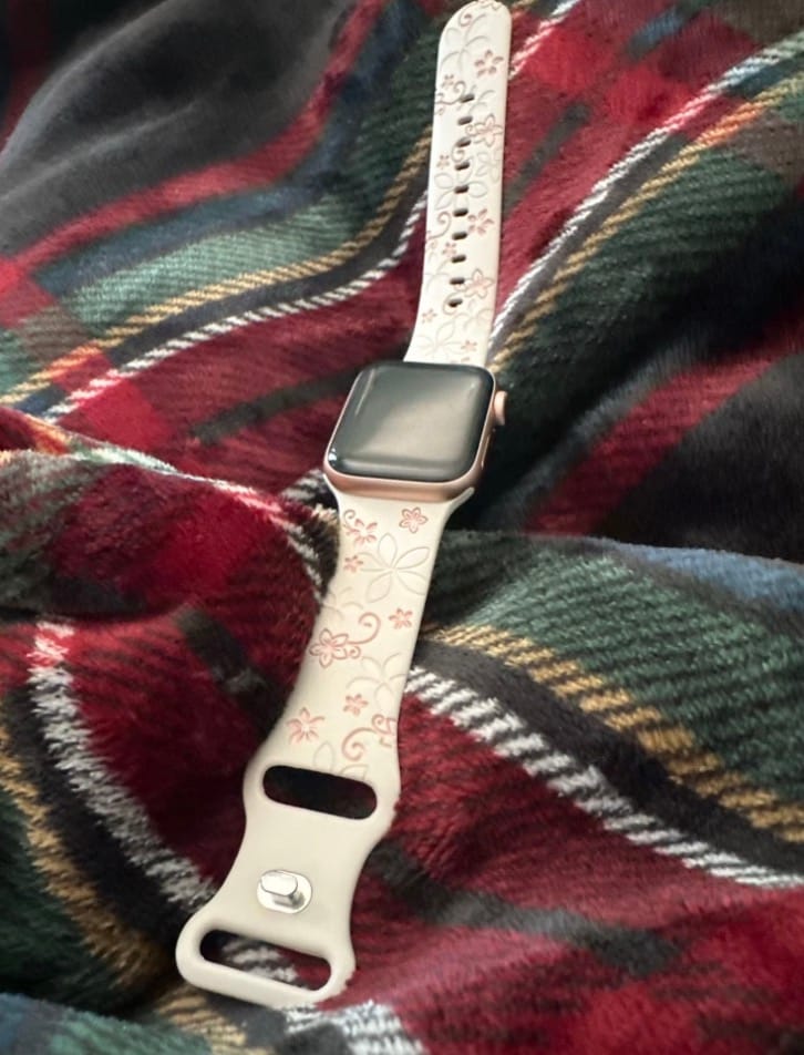 Customer photo review of NEU: Apple Watch Silikonband 'Dianne'
