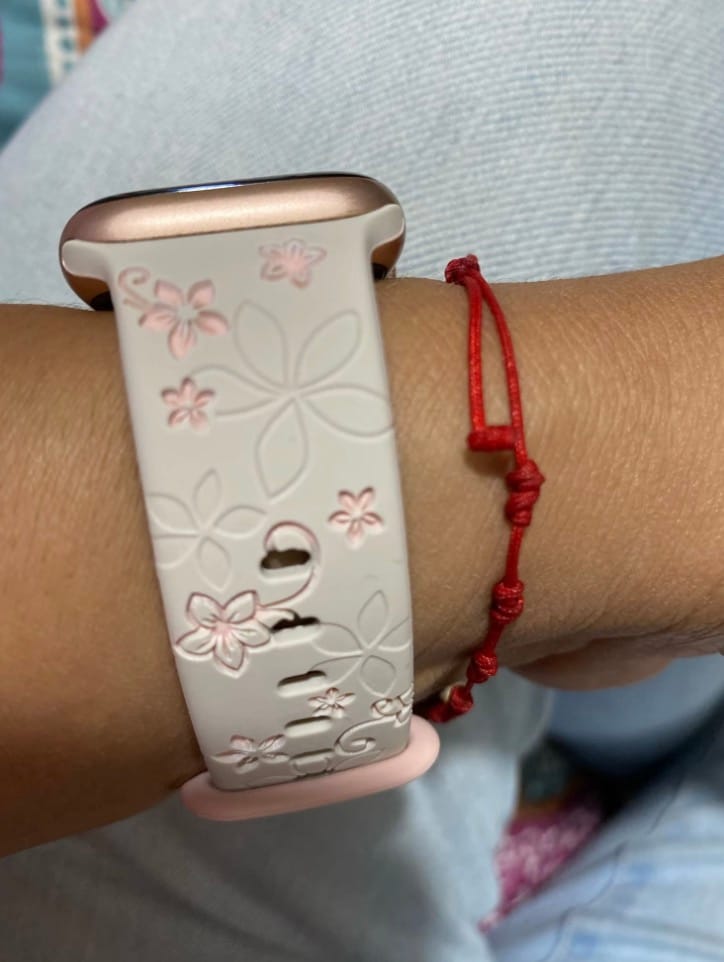 Customer photo review of NEU: Apple Watch Silikonband 'Dianne'