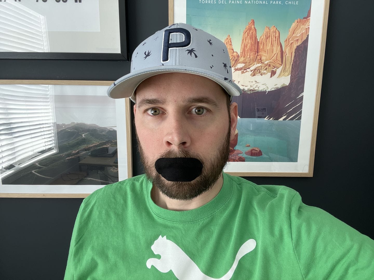 Customer photo review of Mouth Tape for Sleeping - Anti Snoring, Medical Grade, Breathable, Pain Free Removal & Hypoallergenic