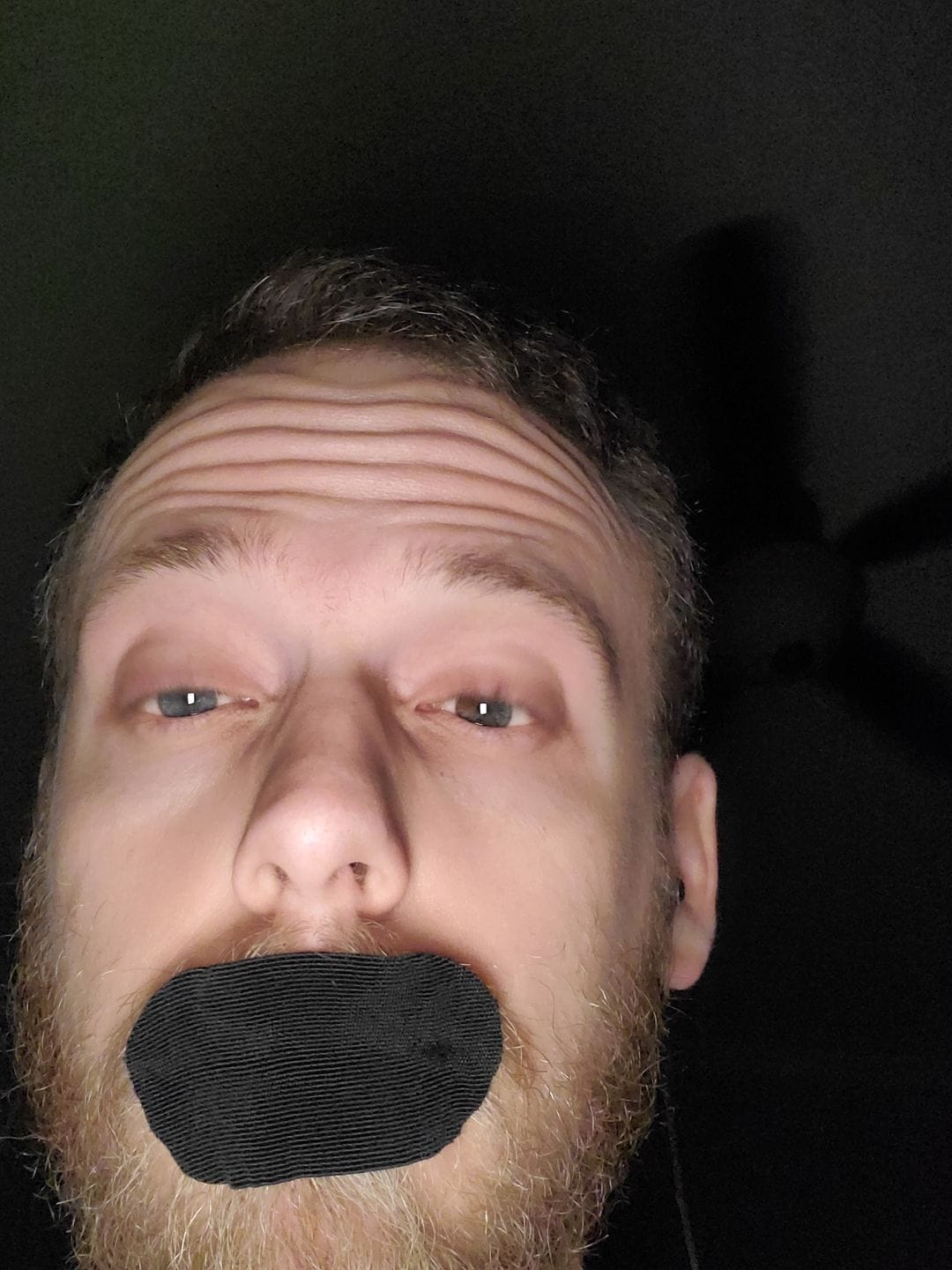 Customer photo review of Mouth Tape for Sleeping - Anti Snoring, Medical Grade, Breathable, Pain Free Removal & Hypoallergenic