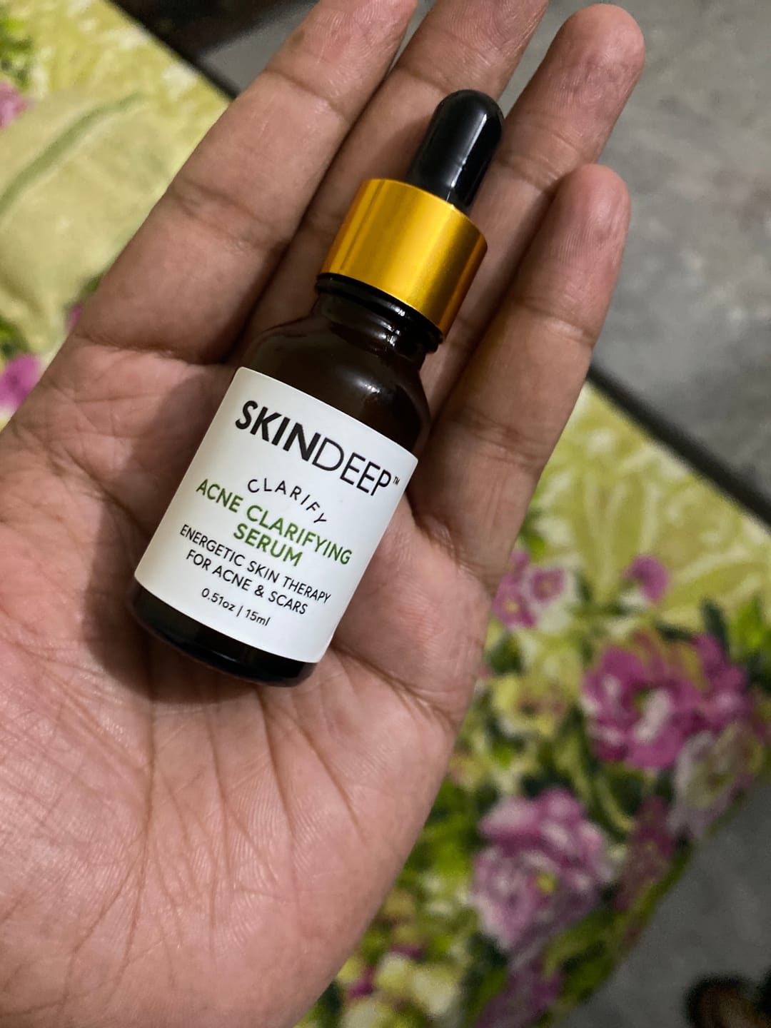 Customer photo review of ACNE CLARIFYING SERUM - Energetic Skin Therapy for Acne & Scars