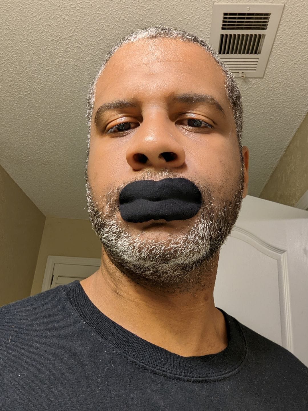 Customer photo review of Mouth Tape for Sleeping - Anti Snoring, Medical Grade, Breathable, Pain Free Removal & Hypoallergenic