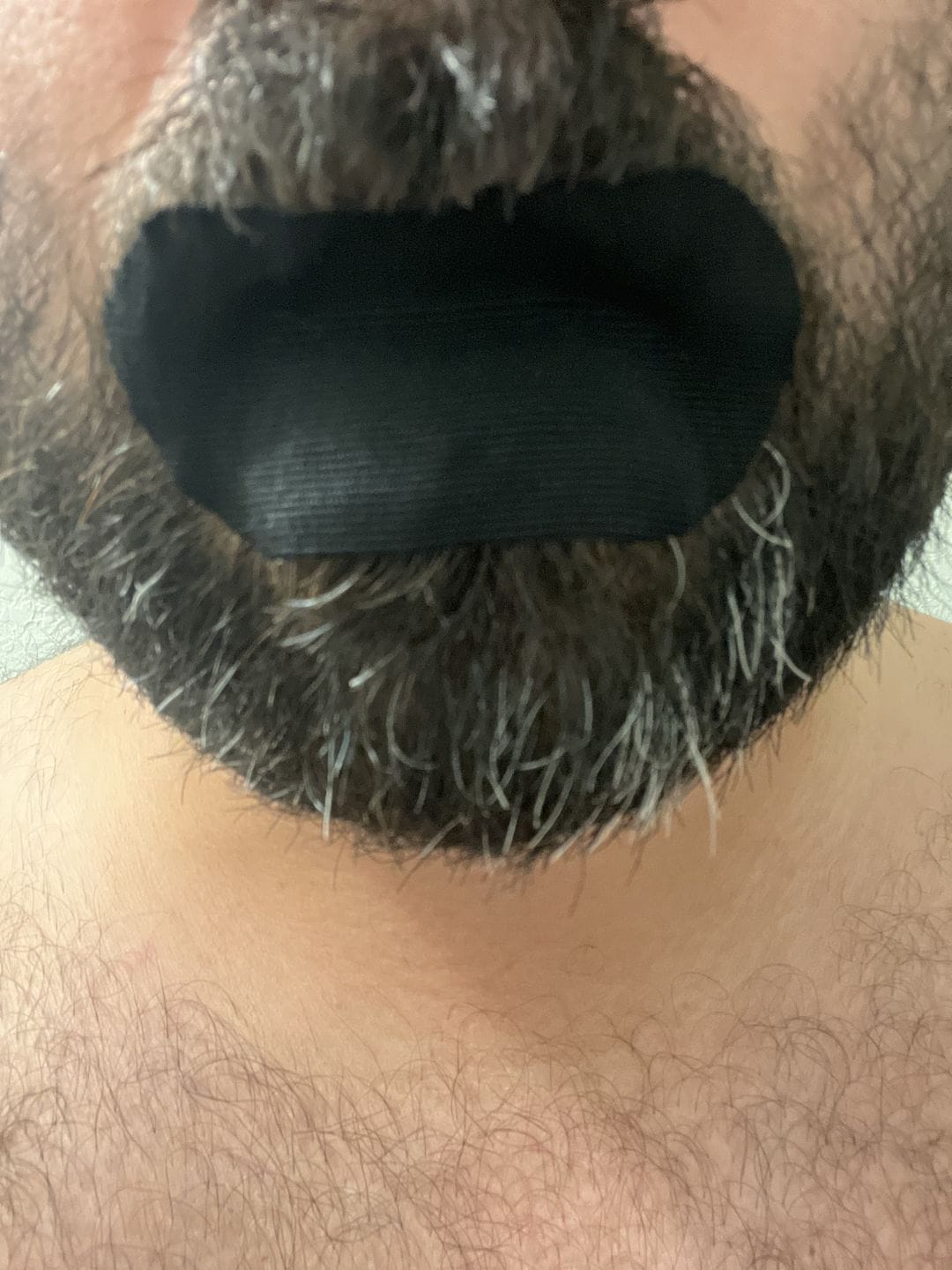 Customer photo review of Mouth Tape for Sleeping - Anti Snoring, Medical Grade, Breathable, Pain Free Removal & Hypoallergenic