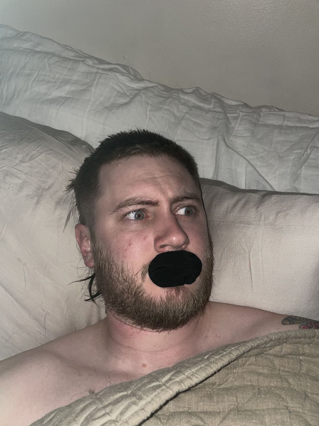 Customer photo review of Mouth Tape for Sleeping - Anti Snoring, Medical Grade, Breathable, Pain Free Removal & Hypoallergenic
