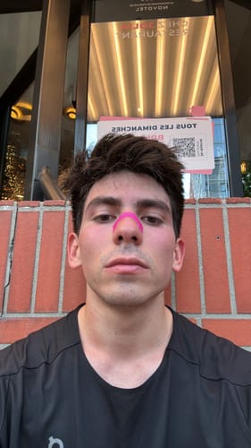 Customer photo review of Black Nasal Strips