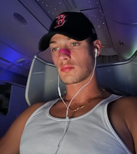 Customer photo review of Black Nasal Strips