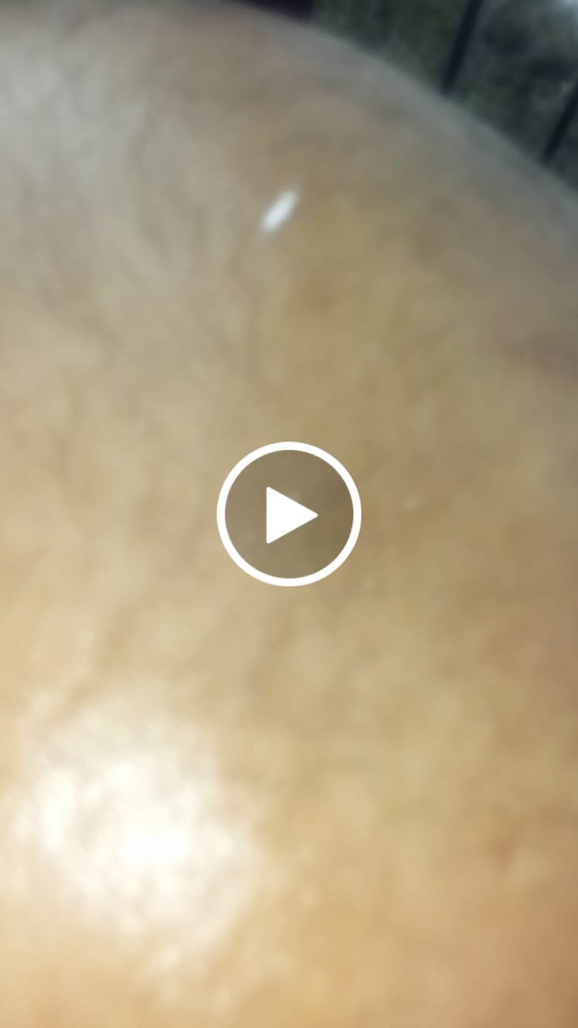 Customer video review of 100% Unrefined Batana Oil 4 oz