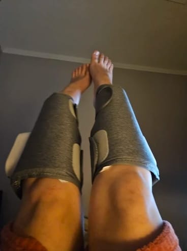 Customer photo review of Minasa - 3-in-1 Massagegerät für schmerzfreie und vitale Beine