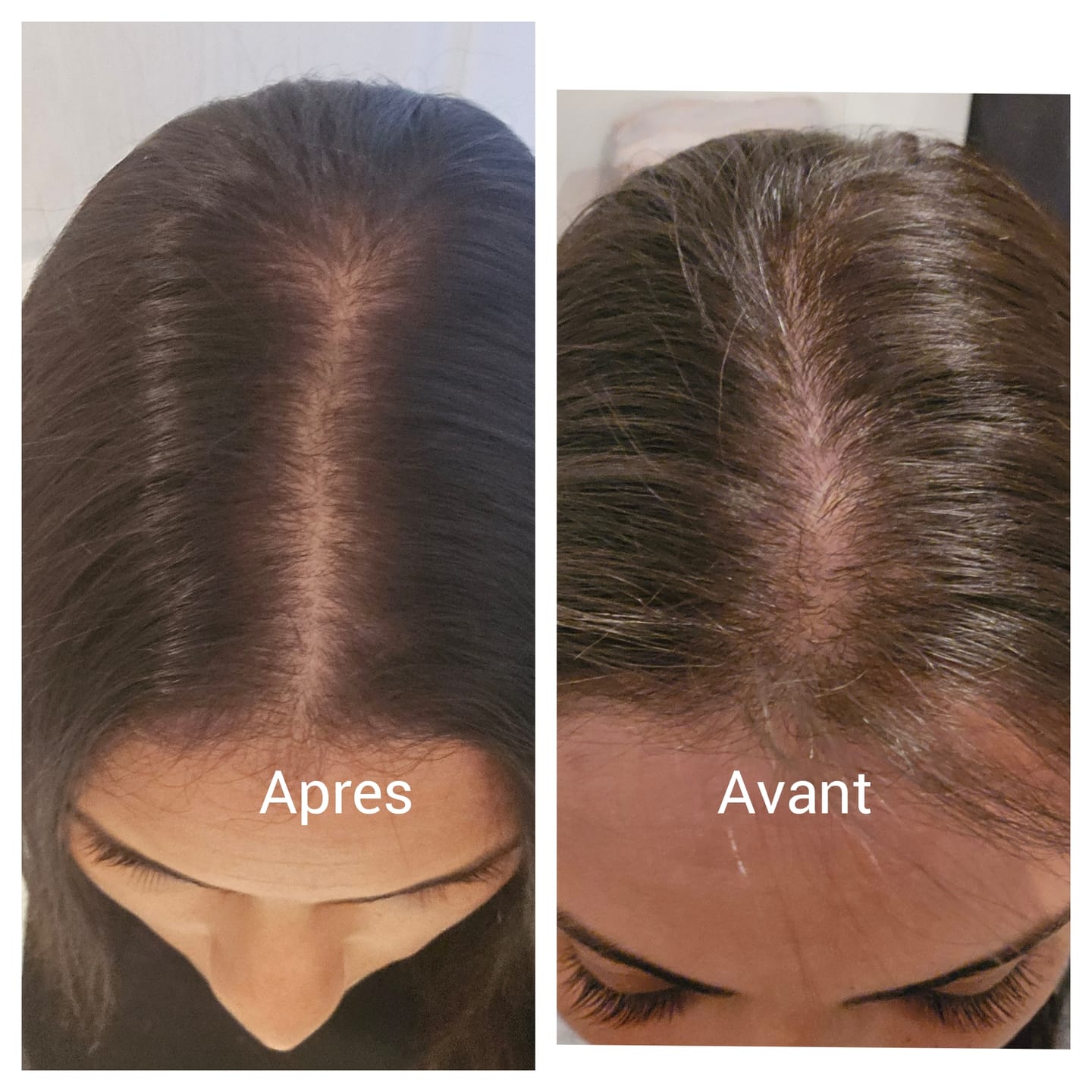 Customer photo review of Shampoing Solide Gingembre Anti chute & Pousse de cheveux - ECLAMA