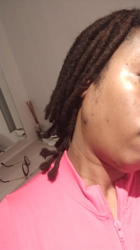 Customer photo review of Turmeric Glow Soap