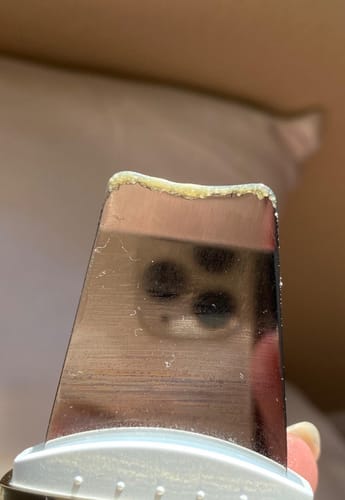 Customer photo review of Ultrasonic Skin Scrubber