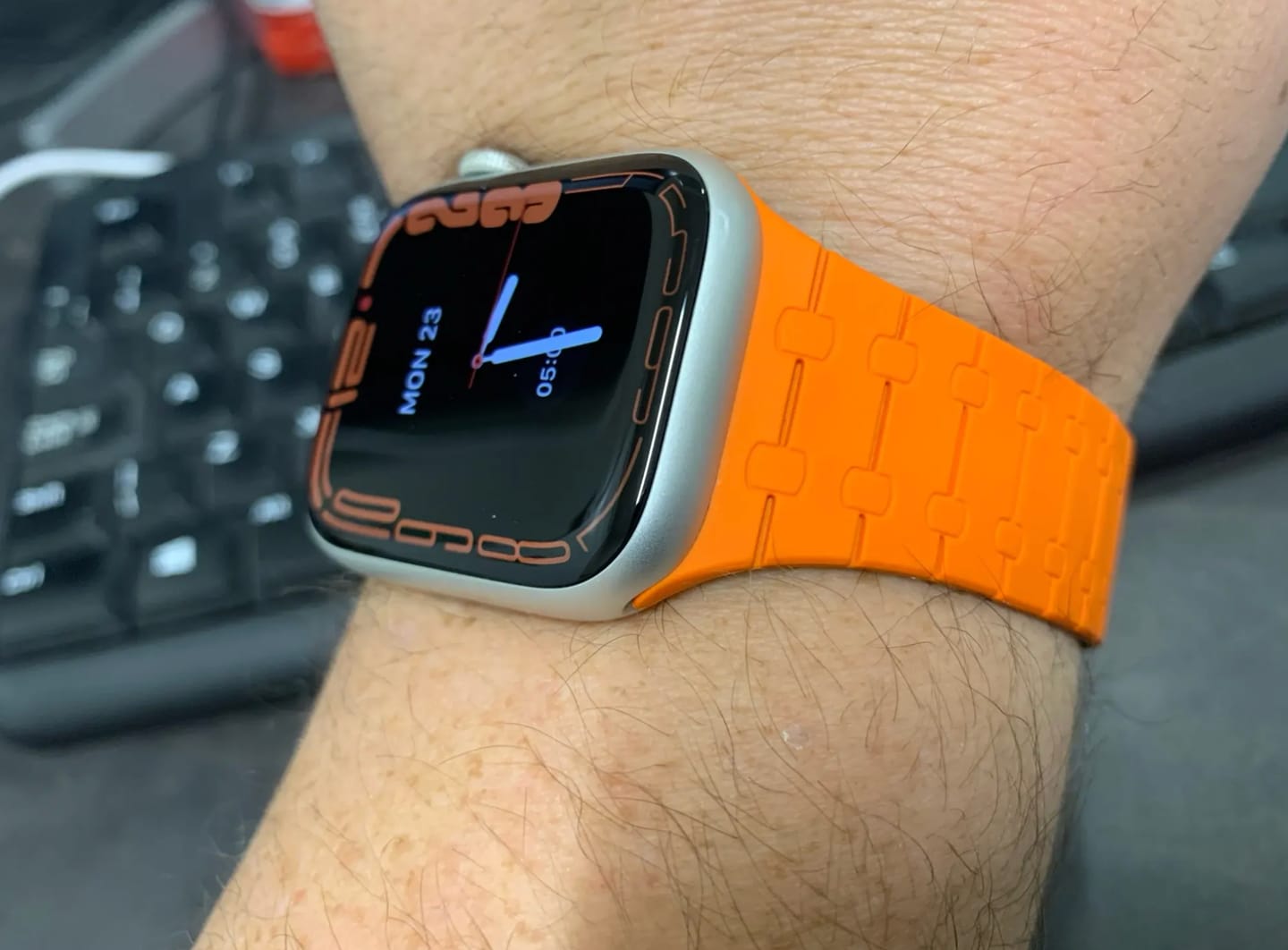 Customer photo review of MagnaFit™ Precision Band