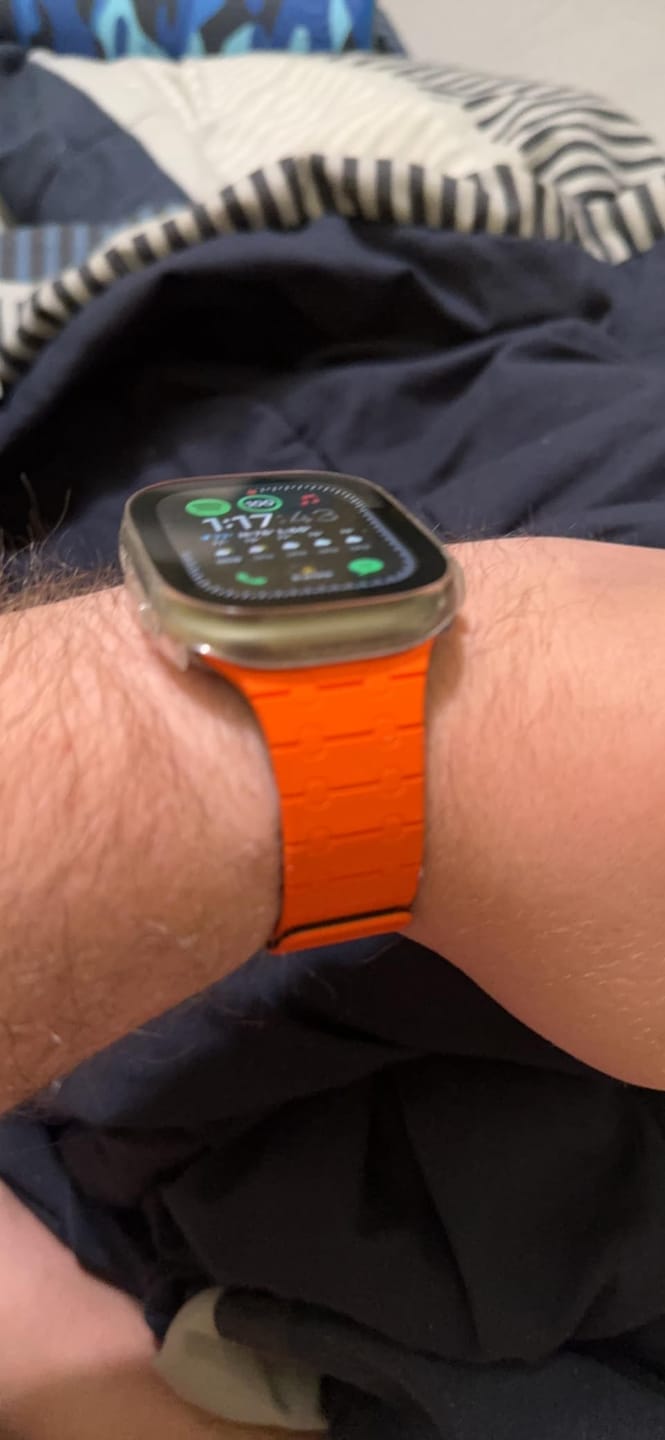Customer photo review of MagnaFit™ Precision Band