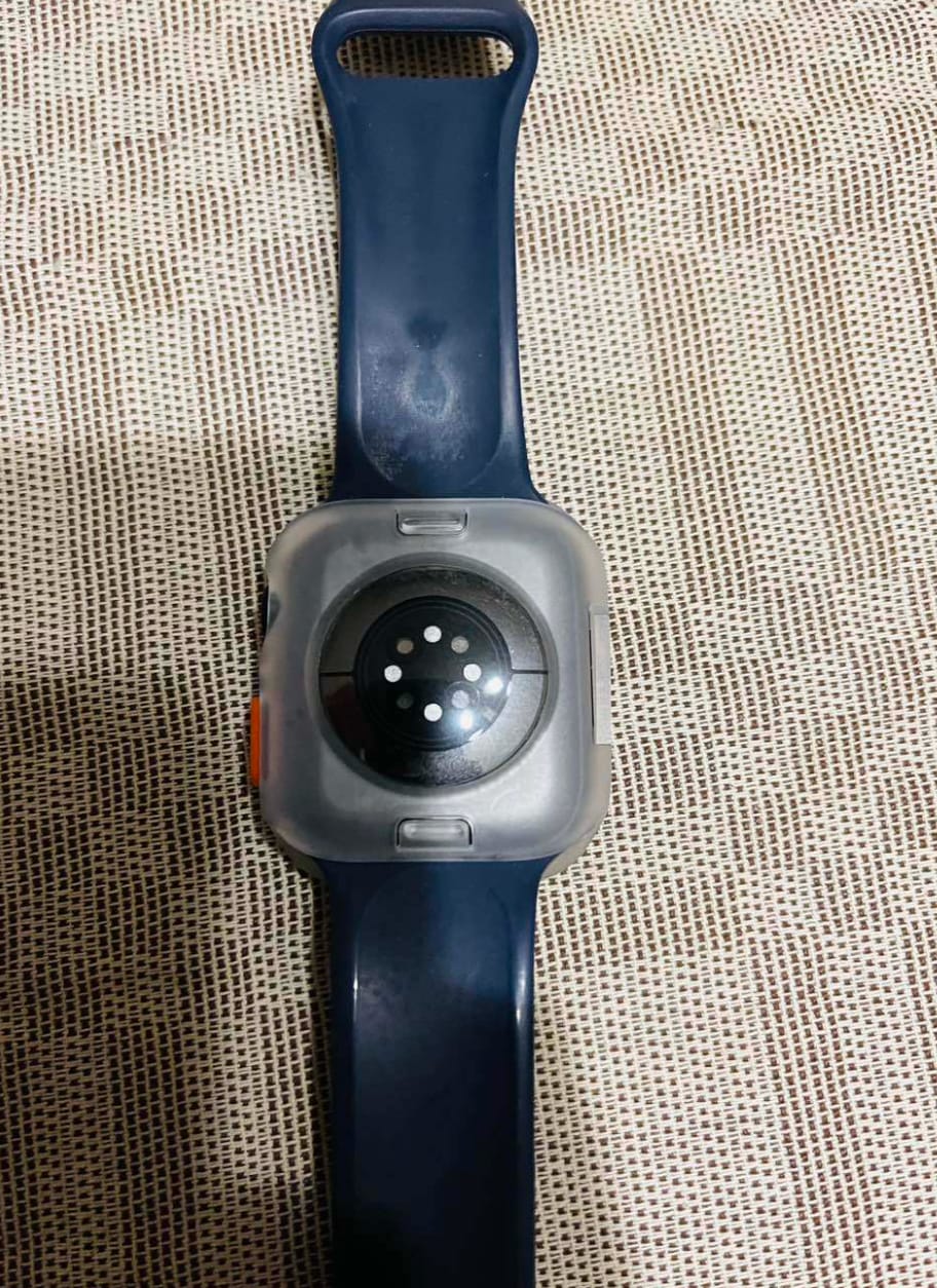 Customer photo review of FlexiFit™ Protective Case