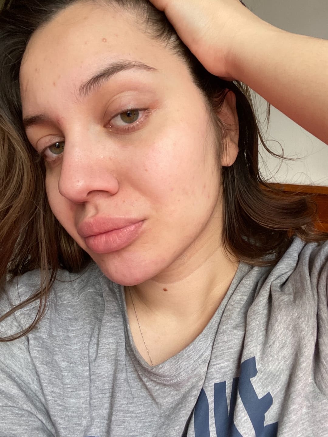 Customer photo review of SkinGlow™ Дълбоко Хидратираща Нощна Маска