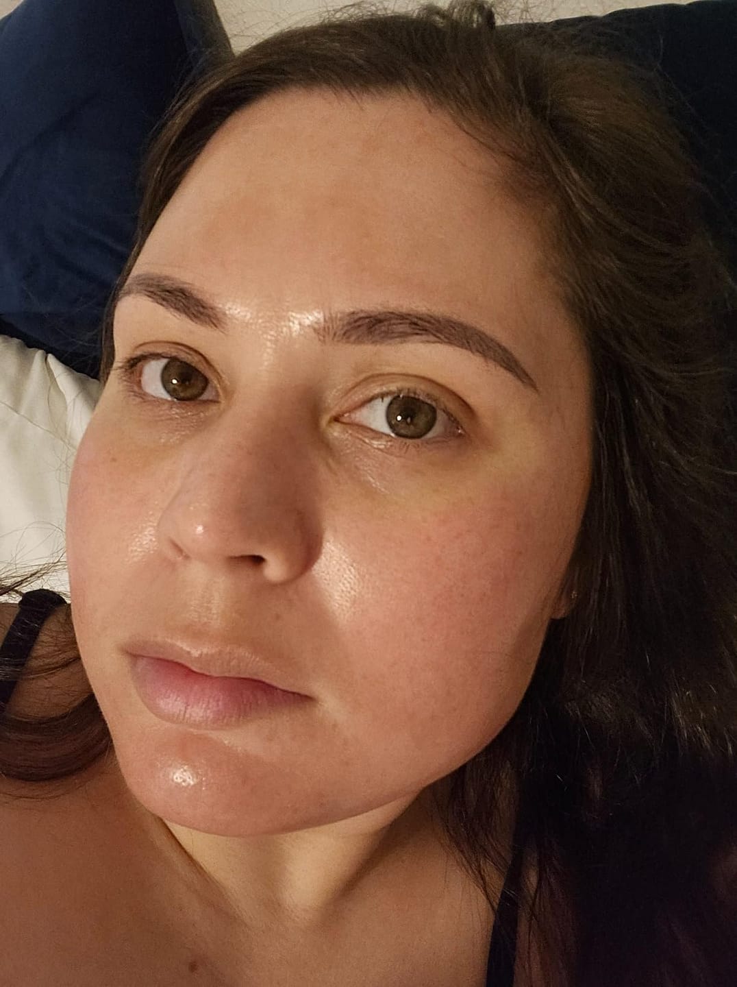 Customer photo review of SkinGlow™ Дълбоко Хидратираща Нощна Маска