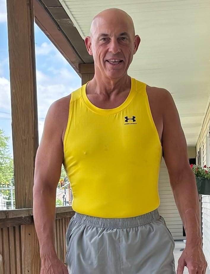 Customer photo review of NextGen Ultra Muscle Stimulator