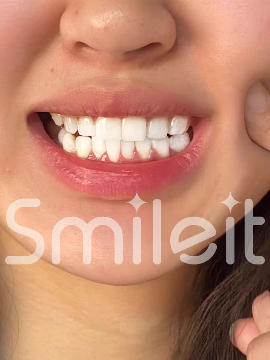 Customer photo review of SmileIt V34 משחה להלבנת שיניים