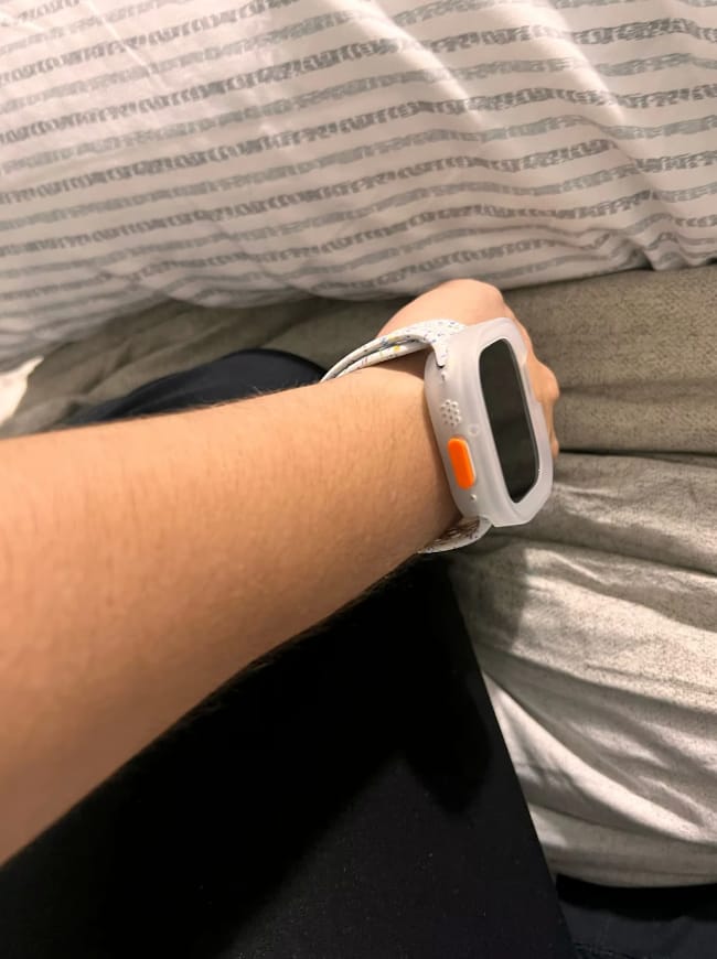 Customer photo review of FlexiFit™ Protective Case