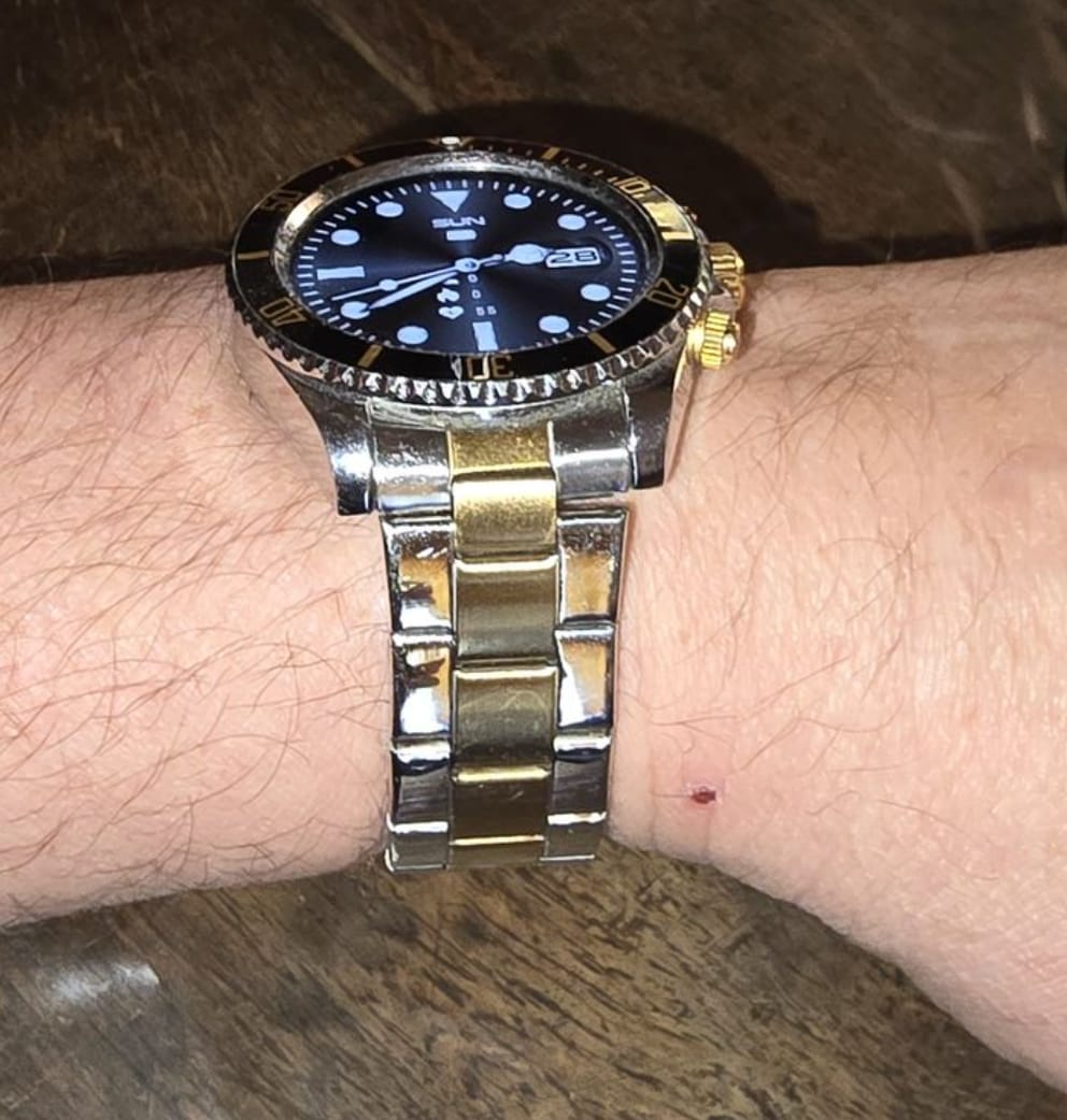 Customer photo review of Nexus Pro Smartwatch