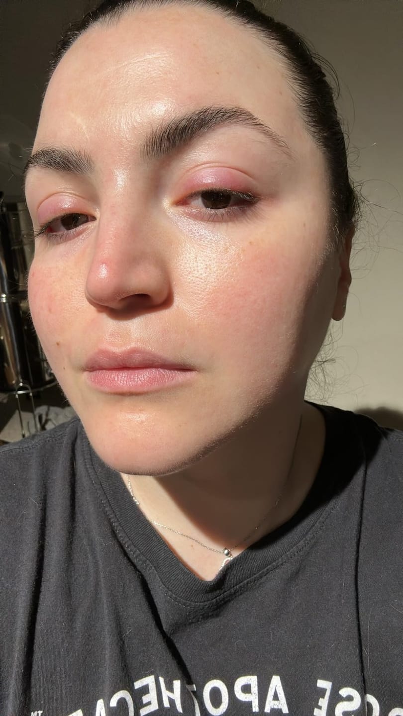 Customer photo review of SkinGlow™ Дълбоко Хидратираща Нощна Маска