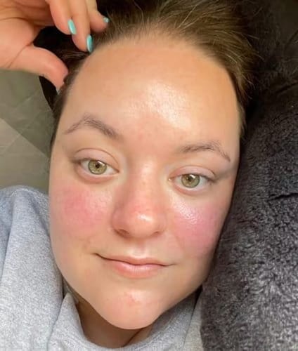 Customer photo review of Kollagen Boosting Maske