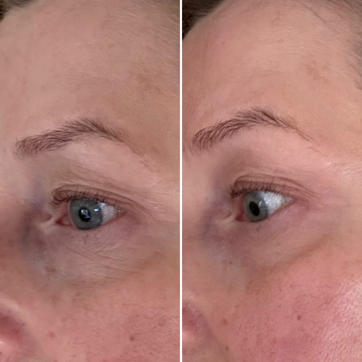 Customer photo review of Anti-Fatigue Eye Mask