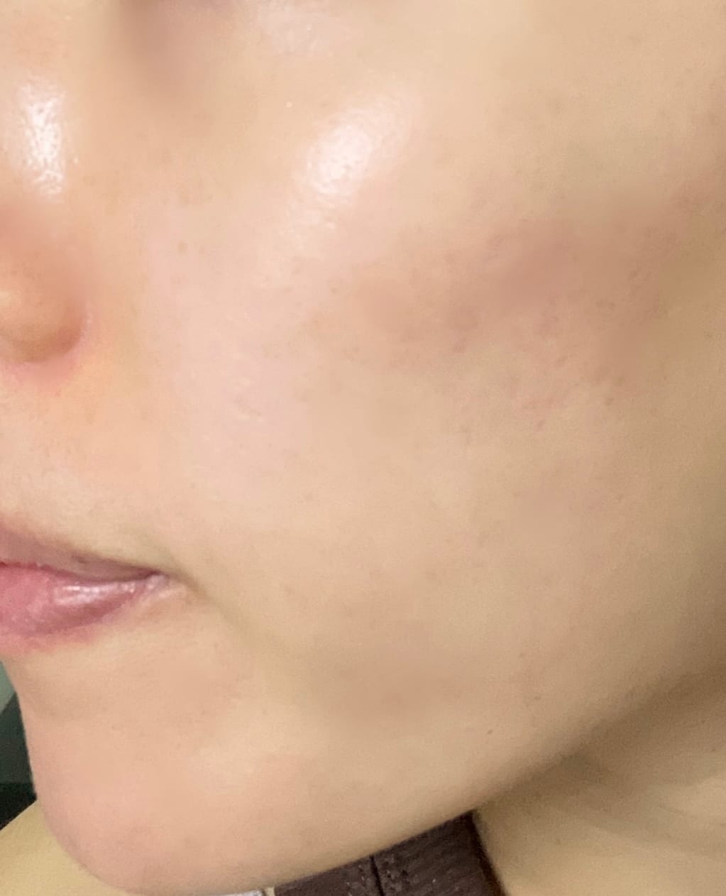 Customer photo review of クレンジングソープ泡ピールケア