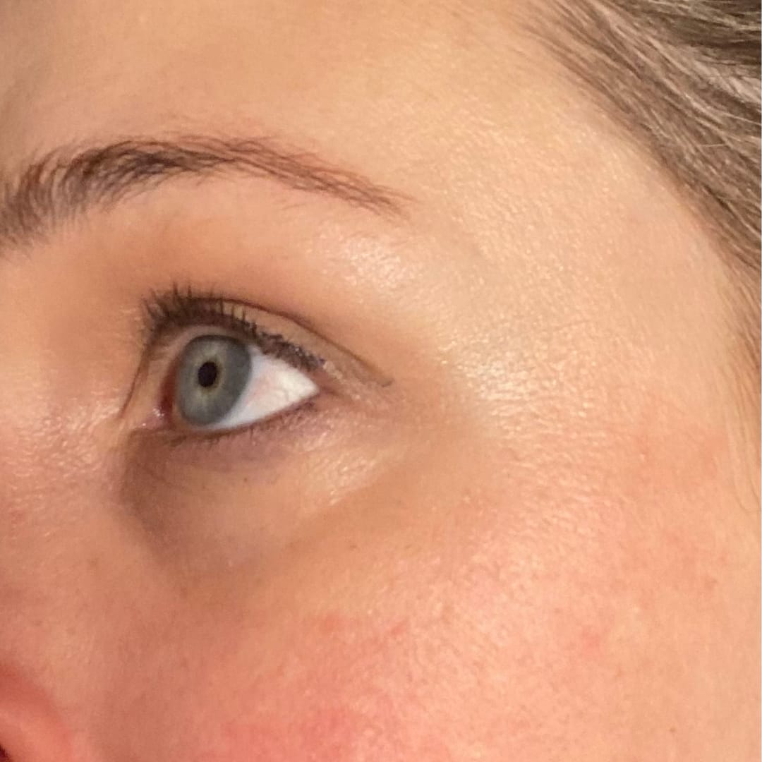 Customer photo review of Anti-Fatigue Eye Mask