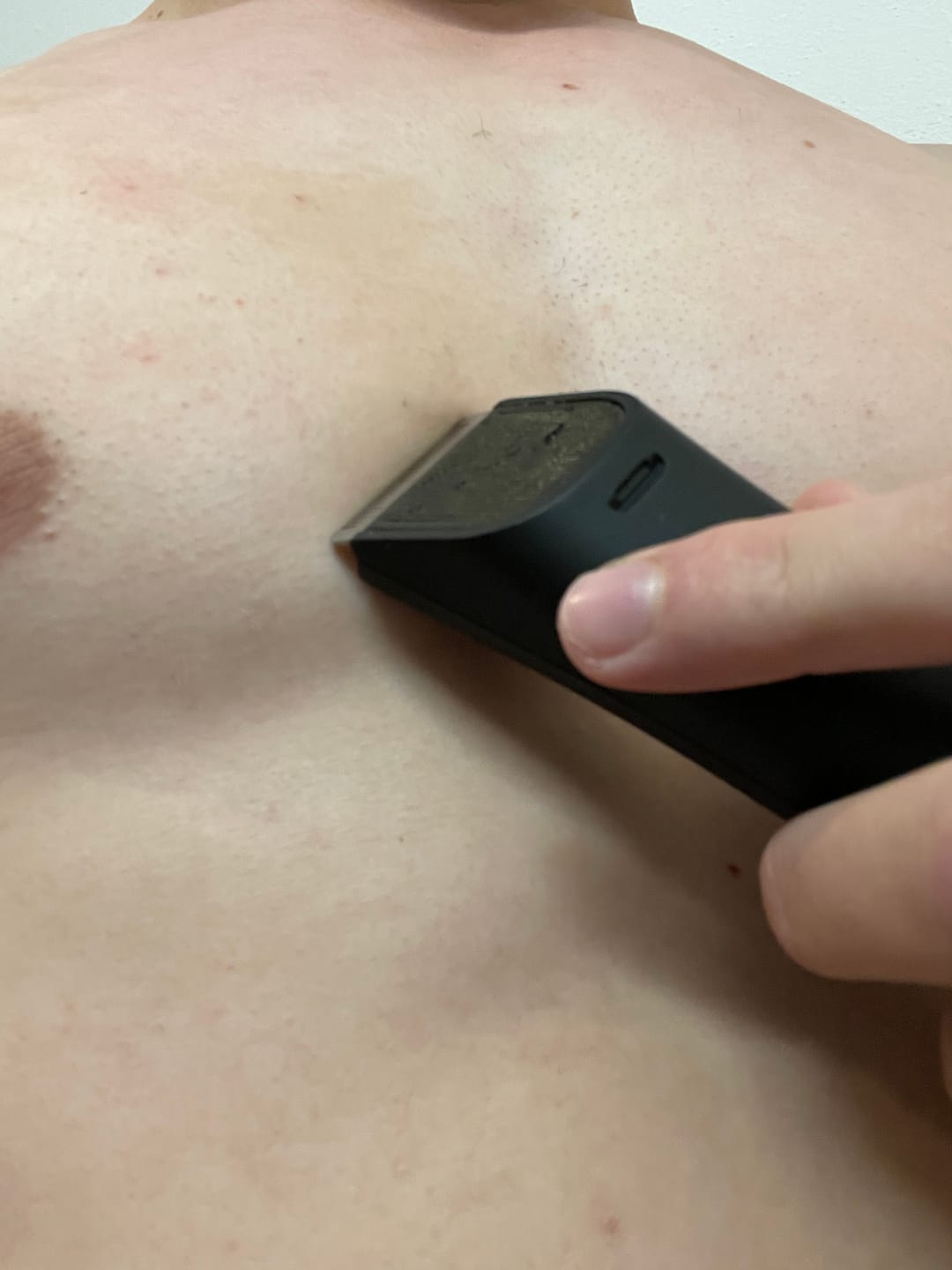 Customer photo review of EVERSHAVE Pro