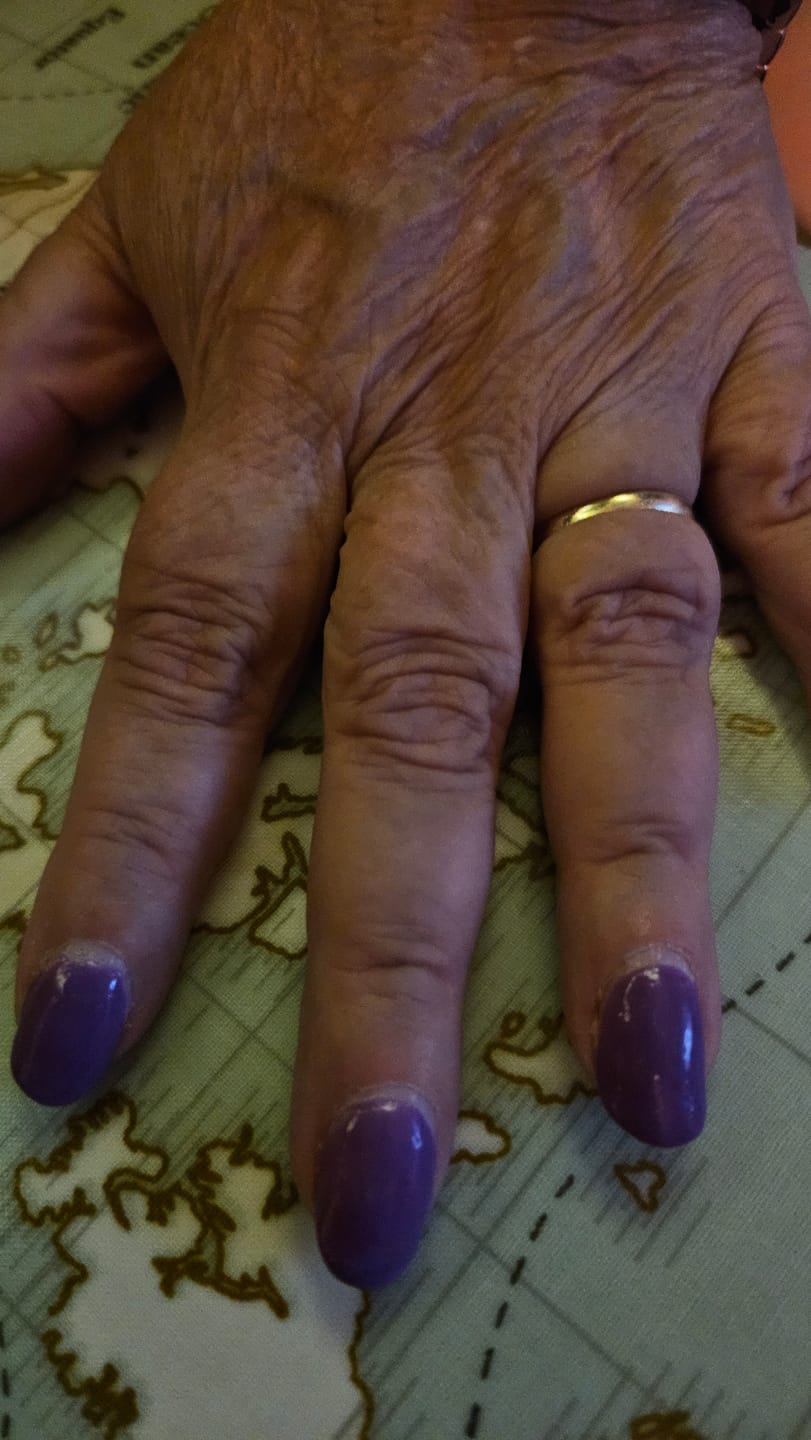 Customer photo review of Top Coat