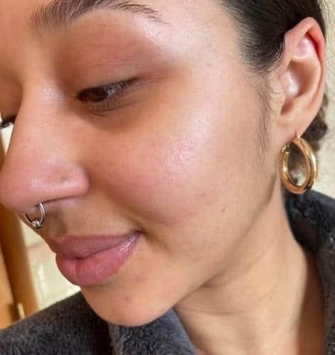 Customer photo review of Kollagen Boosting Maske