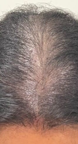 Customer photo review of Follicle Fuel Pro+ – Hair Growth Potion (Extra Strength)