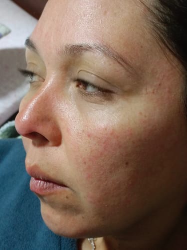 Customer photo review of Emulsión Recuperadora